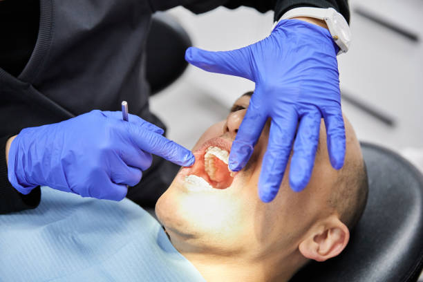 Best Emergency Tooth Extraction in Sedalia, MO